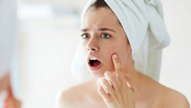 Güzellik Salonunda Yapılan Plazma Pen İşlemi Yargıya Taşındı